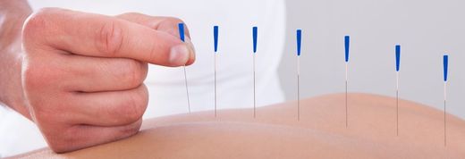 Si tienes fobia a las agujas, encuentra alternativas a la acupuntura